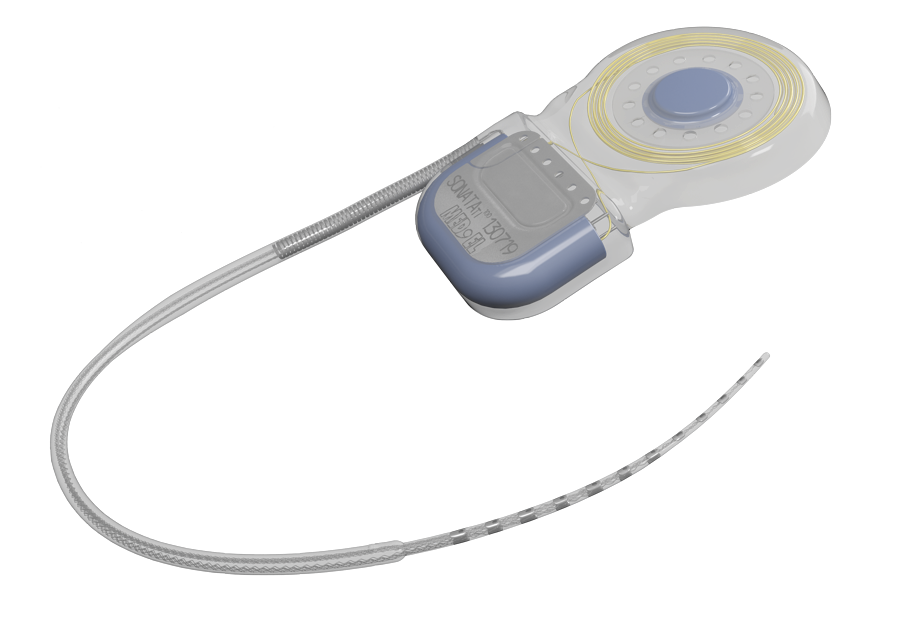 SONATA Cochlear Implant