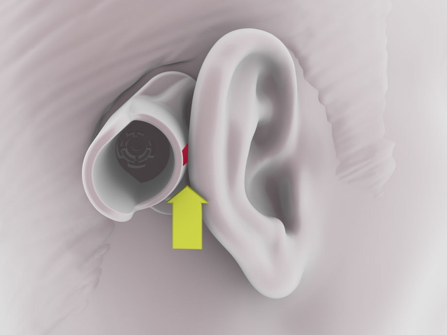 ADHEAR positoning with positioning tool