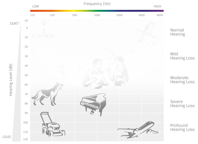 Audiogram showing moderate hearing loss