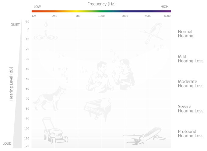 Audiogram showing profound hearing loss