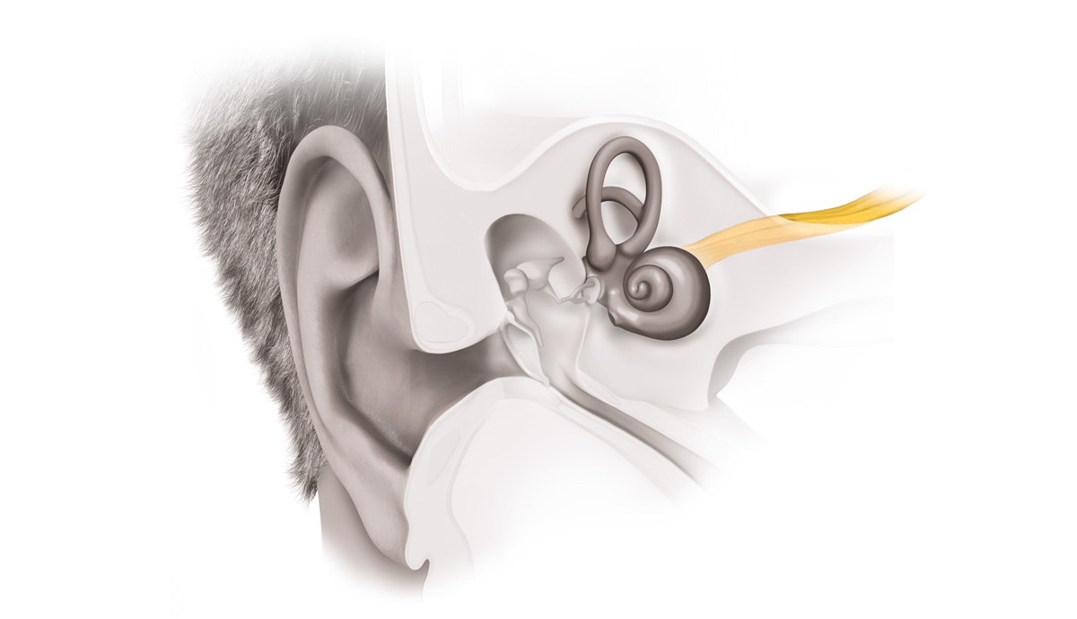 The Auditory Nerve