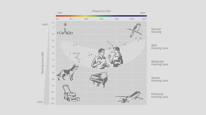 The Audiogram