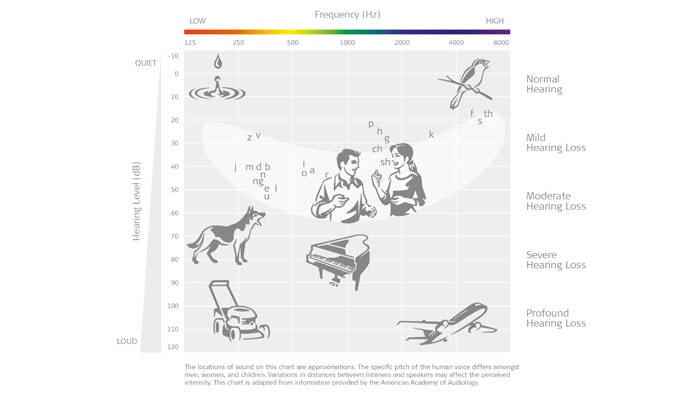 Audiogram Audiogram