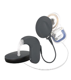 Cochlear Implant System