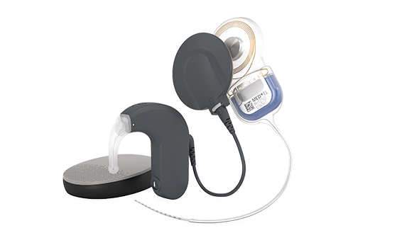 Cochlear Implant System