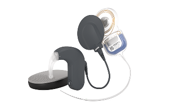 Cochlear Implant System