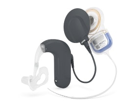 Electric Acoustic Implant System