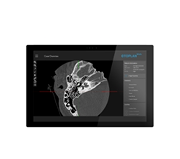 OTOPLAN