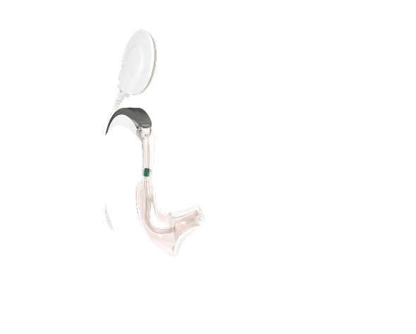 완벽한 매치 완벽한 매치