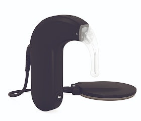 SONNET 3 SONNET 3 behind-the-ear cochlear implant audio processor.