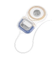 Implant SYNCHRONY 2