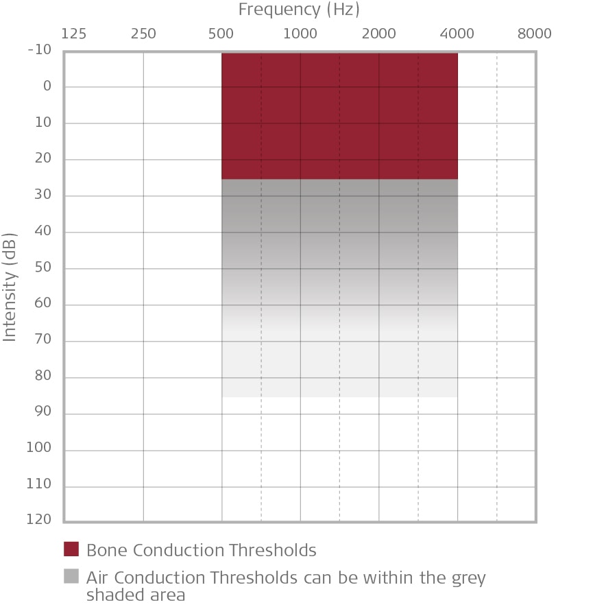 Audiogram