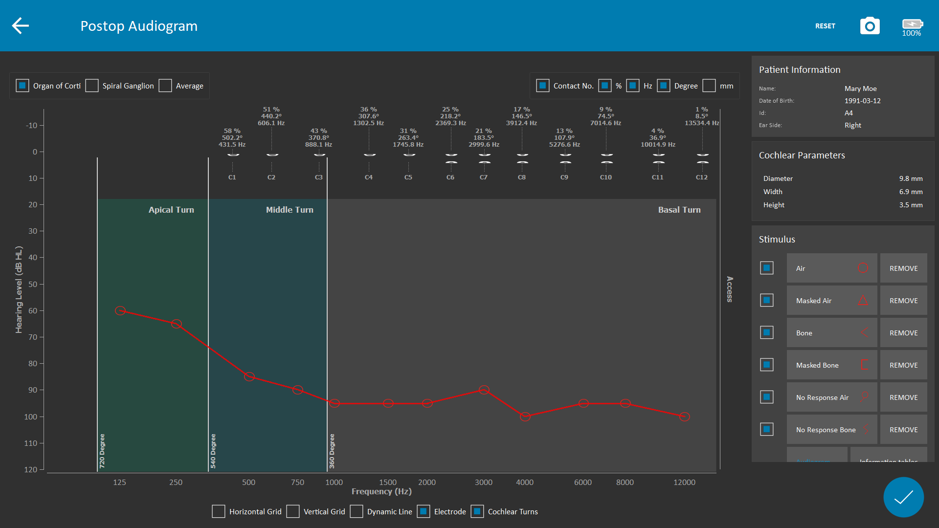 OTOPLAN_screenshot_2022-04-04_13-52-58