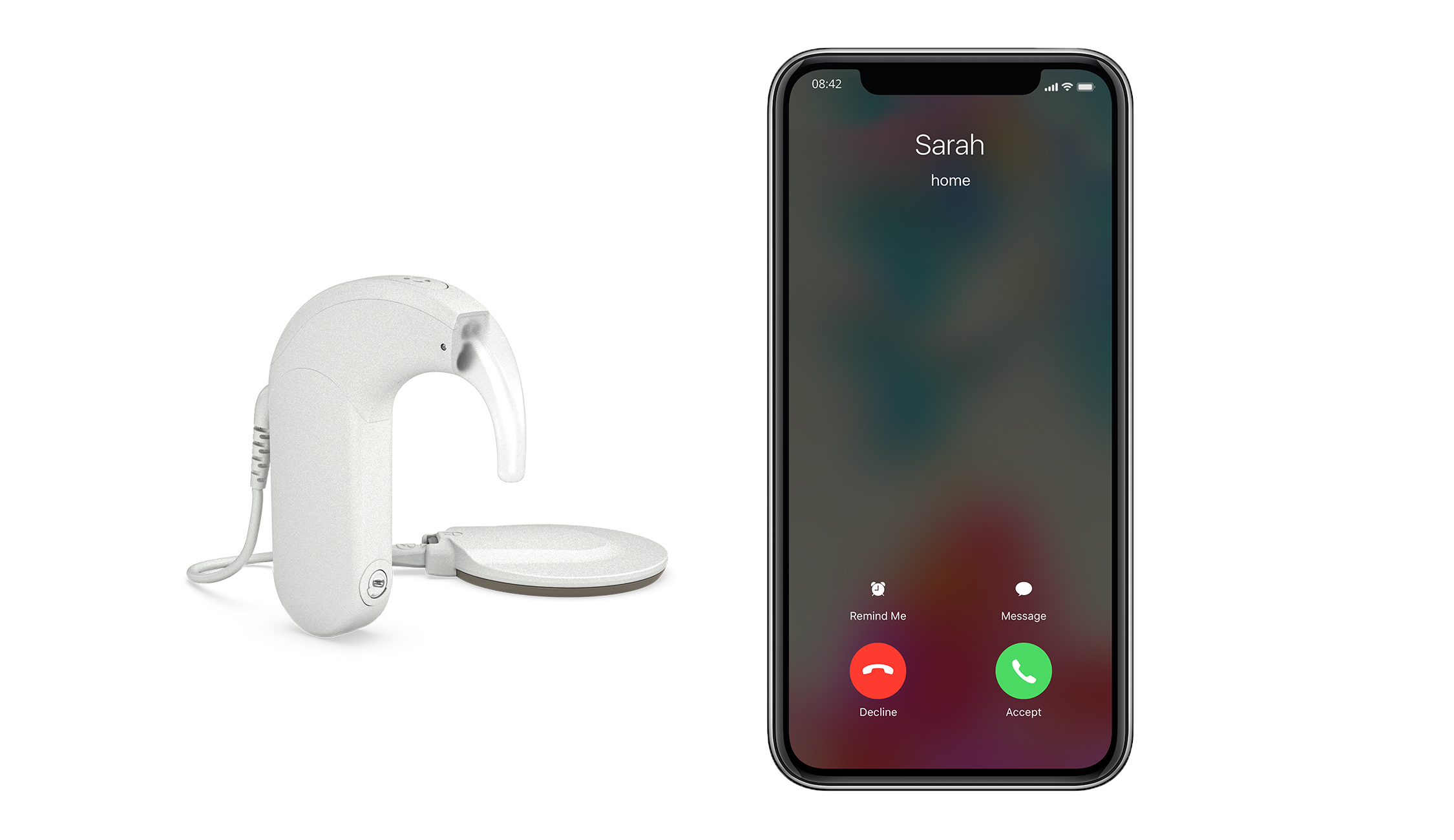 Bimodal Streaming for Apple MED-EL SONNET 3 Audio Processor streaming with an iPhone